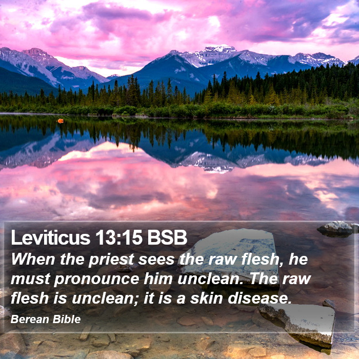 Leviticus 13:15 BSB Bible Study